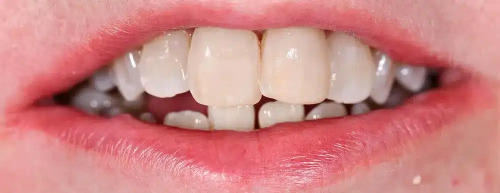 Smile Gallery — Kuser Family Dental