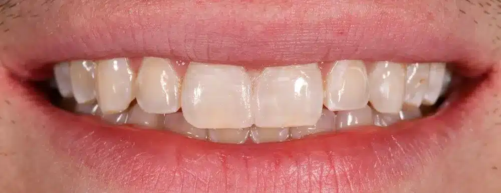 Smile Gallery — Kuser Family Dental