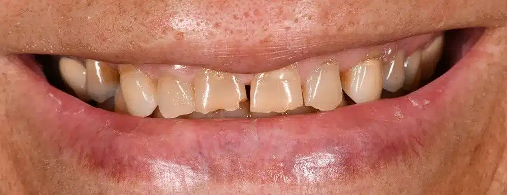 Smile Gallery — Kuser Family Dental