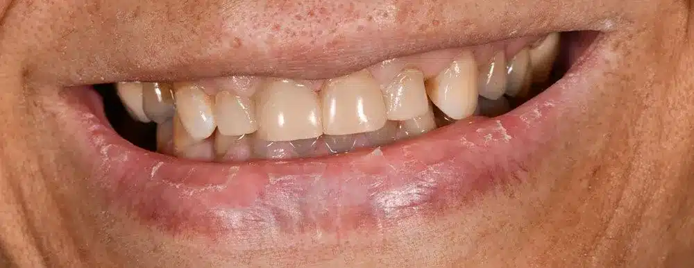 Smile Gallery — Kuser Family Dental