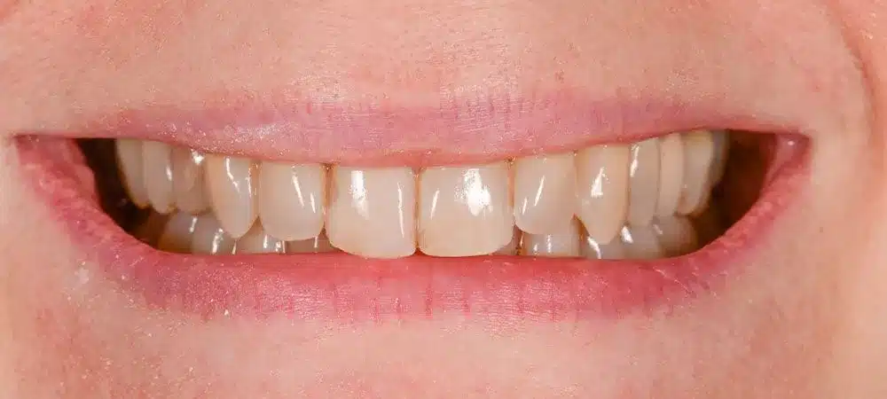 Smile Gallery — Kuser Family Dental