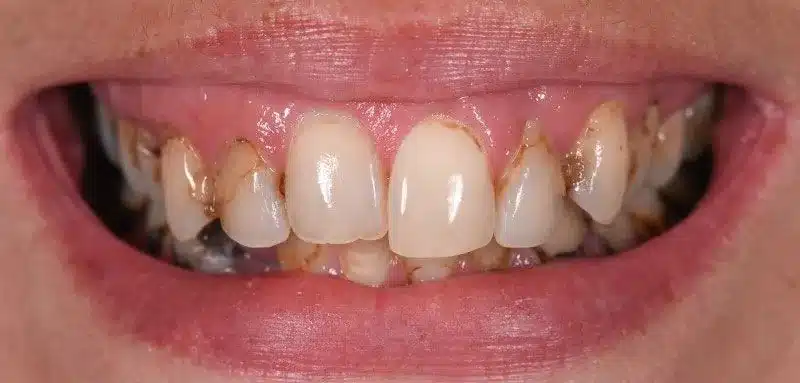 Smile Gallery — Kuser Family Dental
