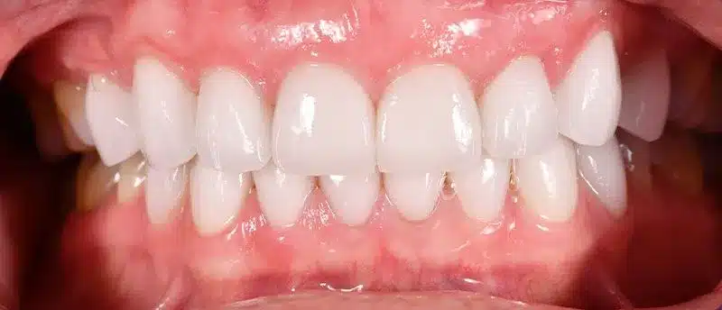 Smile Gallery — Kuser Family Dental